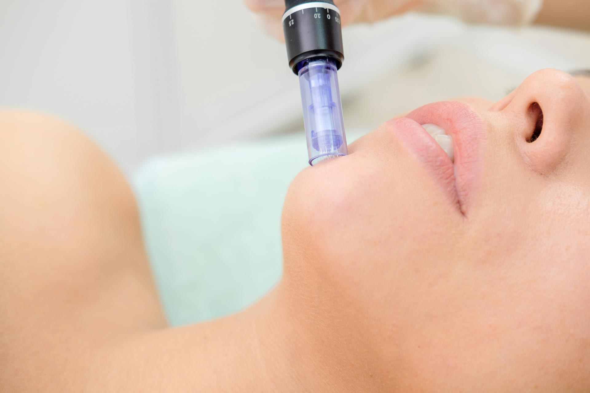 Medizinisches Microneedling